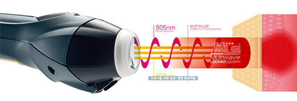 △MLS (Multiwave Locked System) Laser Therapy