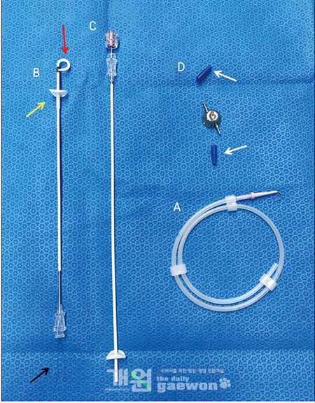 [그림 1] SUB consist 4 part; (A) 0.035””J”-tipped guide wire; (B) 7 Fr nephrostomy catheter with fenestrations (1 cm markings and a fixed Dacron cuff, Hollow cannula & sharp stylet); (C) Bladder catheter; (D) Shunting port (Herber needle for patency of implant).