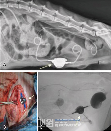 [그림 2] A lateral radiograph of a cat with a unilateral SUB and a contralateral ureteral stent (A). Surgical picture of the SUB that is being secured to the port (B). Injection of the SUB using fluoroscopic guidance through the port (C). Notice a Huber needle being used to inject the port resulting in a nephrogram, cystogram and ureterogram. Because of contralateral stent patency there is contrast filling the contralateral renal pelvis.