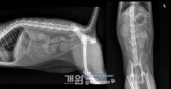 [그림 5] 좌측 신장 음영의 위치로 mineral opacity 음영이 다수 관찰. Lateral view에서 L4-5 level의 retroperitoneal space, VD view에서 L3 level의 좌측 proximal ureter, L5 level의 midline 양측으로 mineral opacity 음영이 다수 관찰. 좌측 신장 음영은 L2 길이의 2.3배 정도로 정상 범위 내 size로 관찰, 우측 신장 음영은 L2 길이의 3배 정도로 크고, irregular margin으로 관찰.