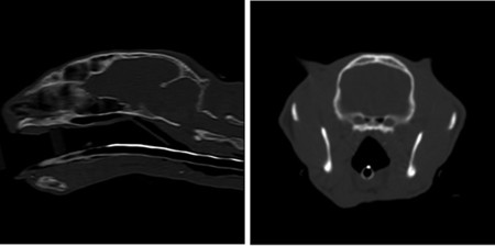 [그림 1] CT 검사 결과 Nasopharyngeal stenosis 확인