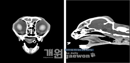 [그림 2] CT 검사에서 Rhinosinusitis 확인