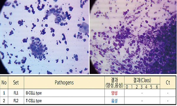 [표 7] 비강 brush cytology 및 PARR 검사 결과