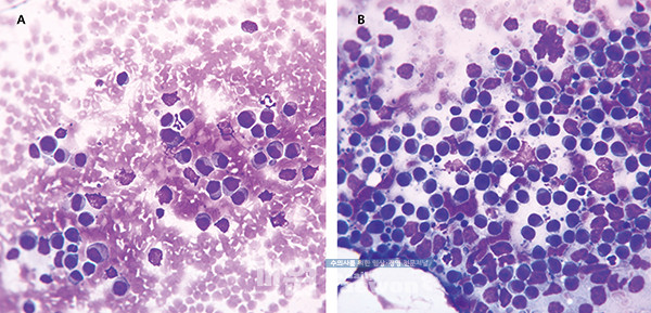 [Fig 2] 세포학검사 사진. A는 비장이고, B는 prescapular LN의 슬라이드 사진이다.