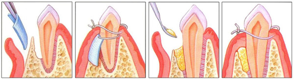 fig 03